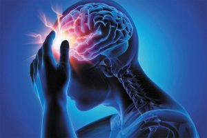Illustration of person putting putting their left hand against the frontal lobe area of their head which is radiating headache pain